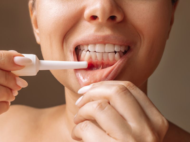 servicio de periodoncia en fusa