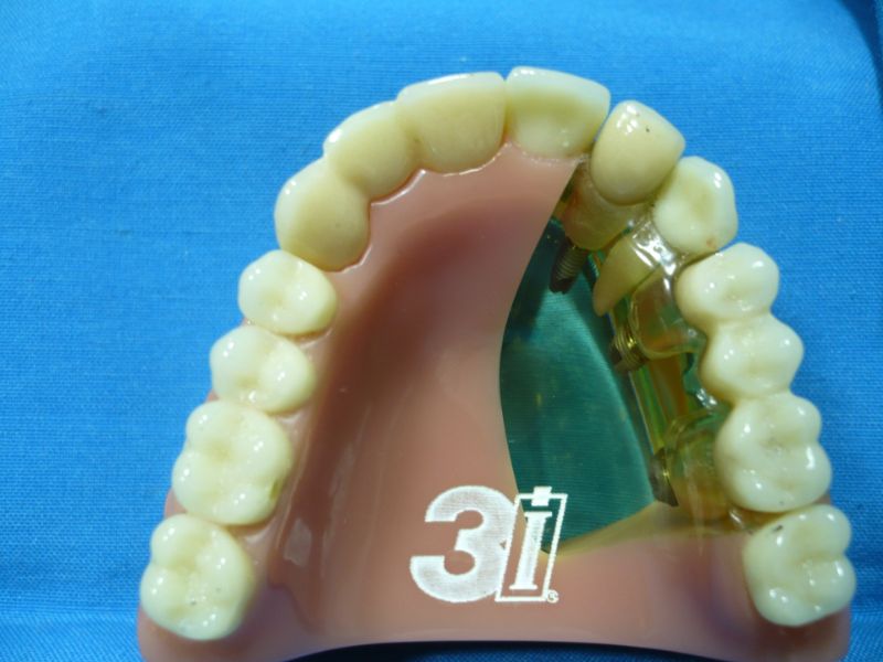tratamiento de rehabilitacion oral fusacatan